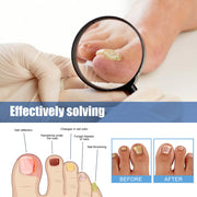Nail Repair Bandage